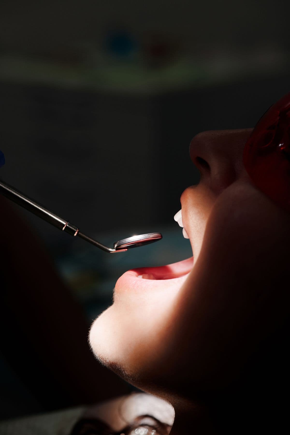 Preventing Tooth Cavities: Expert Dental Tips for a Healthy Smile