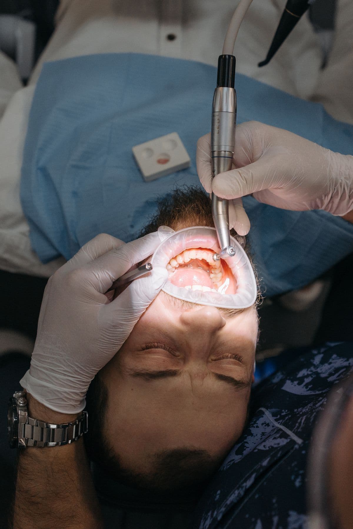 Effective RCT Pain Relief Treatment Options